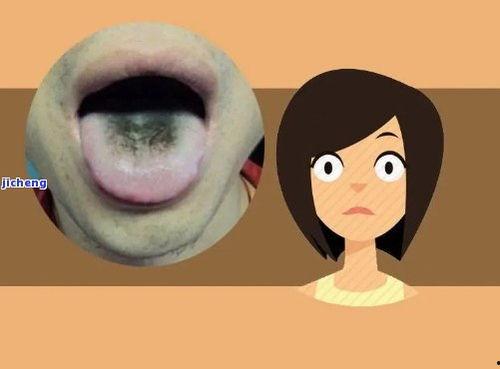 吃瓜后舌头黑怎么回事,吃瓜后舌头变黑之谜