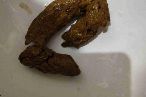 吃佛手瓜大便黑正常吗图片,揭秘健康饮食小常识