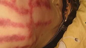 扯痧视频,传统养生新体验